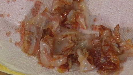 салат с картофелем, беконом, фасолью и яйцами пашот